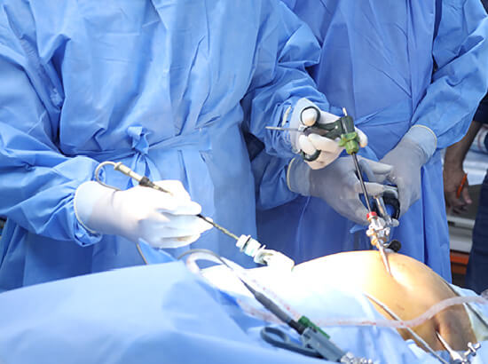 Surgical Treatment of Hernia